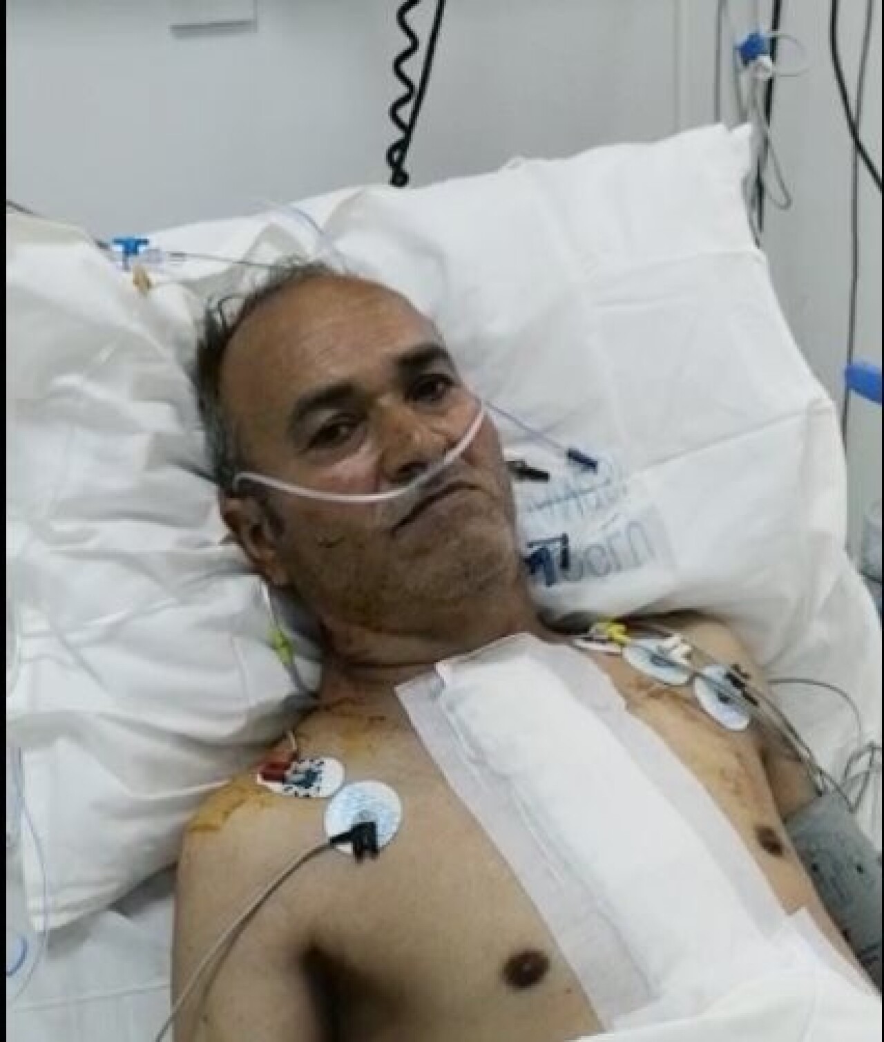 KKTC’de ilk kalp nakli gerçekleşti