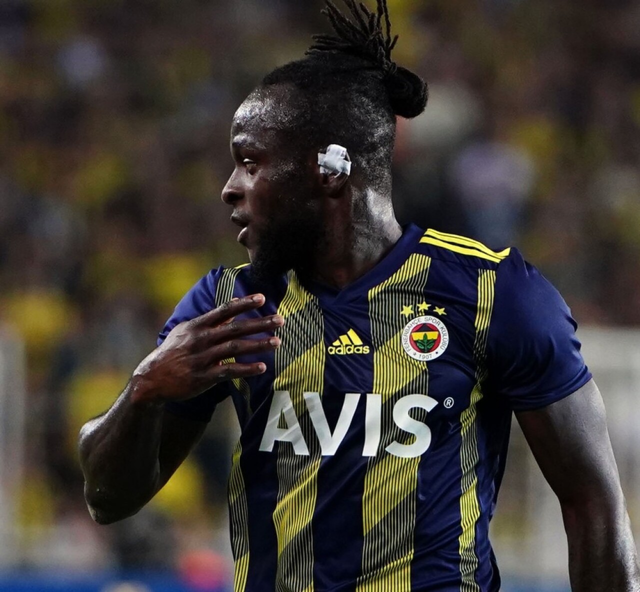 Fenerbahçe’nin Gazişehir Gaziantep ile oynadığı maçta sakatlanan Victor Moses’ın 5 hafta sahalardan uzak kalması bekleniyor.