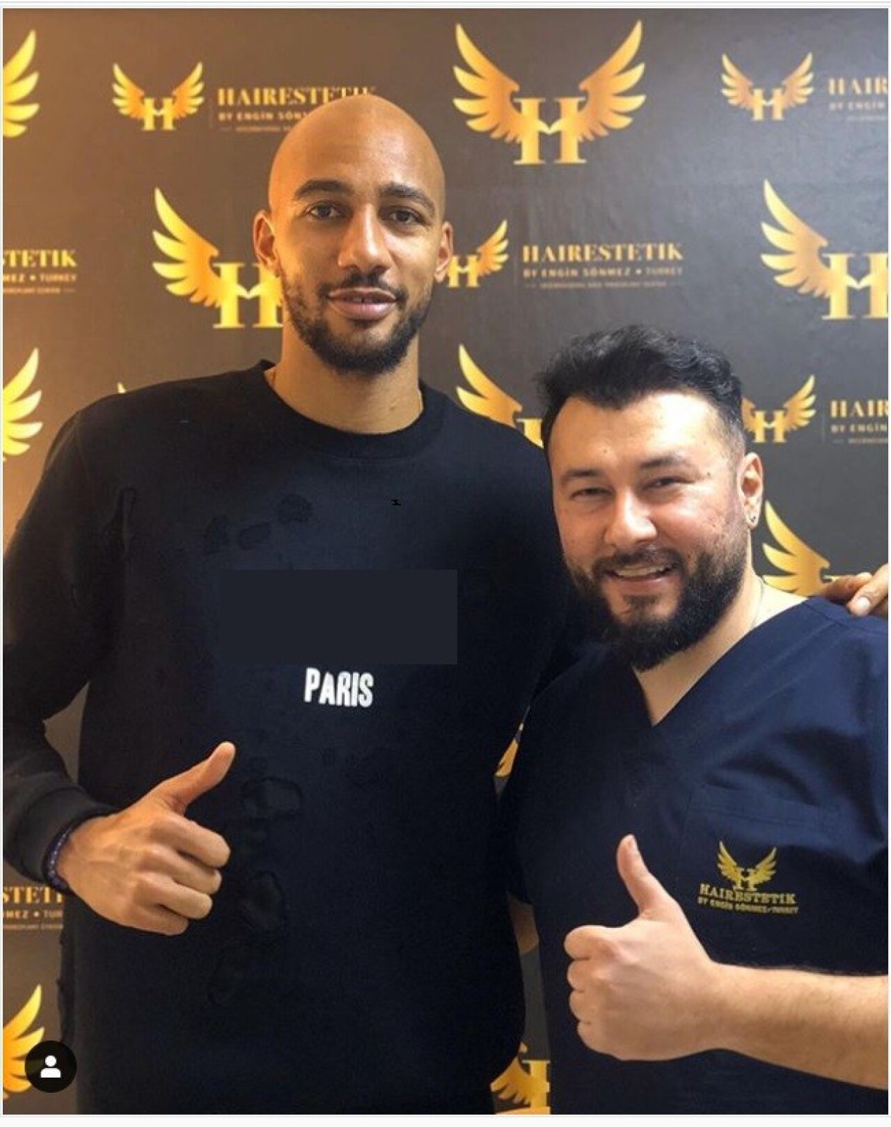Galatasaraylı Nzonzi sakal tedavisi oluyor