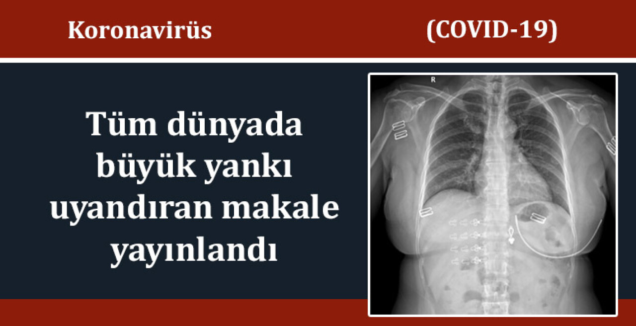 Koronavirüsün tanı ve tedavisinde önemli bilgiler sunan makale Balkan Medical Journal'de yayınlandı