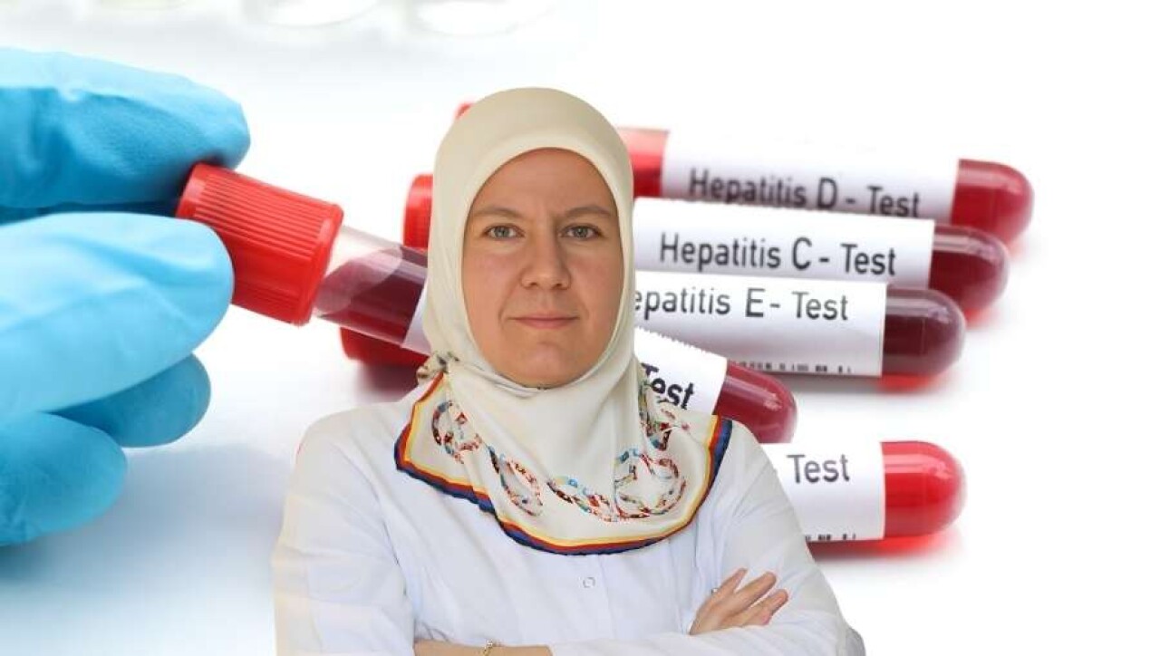 Tedavi Edilmeyen Hepatit Ölümcül Olabiliyor!