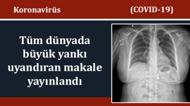 Koronavirüsün tanı ve tedavisinde önemli bilgiler sunan makale Balkan Medical Journal'de yayınlandı