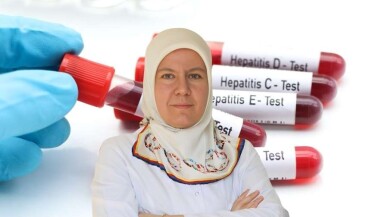 Tedavi Edilmeyen Hepatit Ölümcül Olabiliyor!