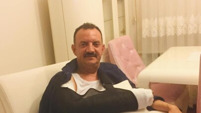 Başkan yardımcısı top oynarken kolunu kırdı