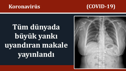 Koronavirüsün tanı ve tedavisinde önemli bilgiler sunan makale Balkan Medical Journal'de yayınlandı