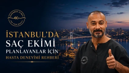 İstanbul’da Saç Ekimi Planlayanlar İçin Hasta Deneyimi Rehberi