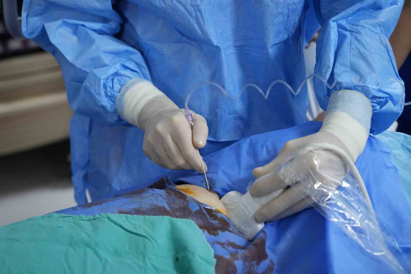 igneyle-tumor-tedavisine-uluslararasi-ilgi-canli-canli-izlediler