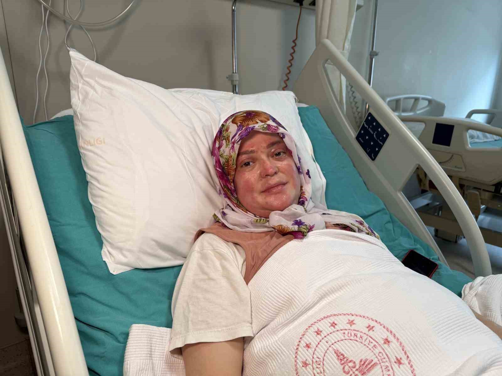 karavandaki-patlama-sonrasi-vucudunun-yuzde-70i-yandi-karadeniz-turu-yapacaktik-alev-topuna-dondum
