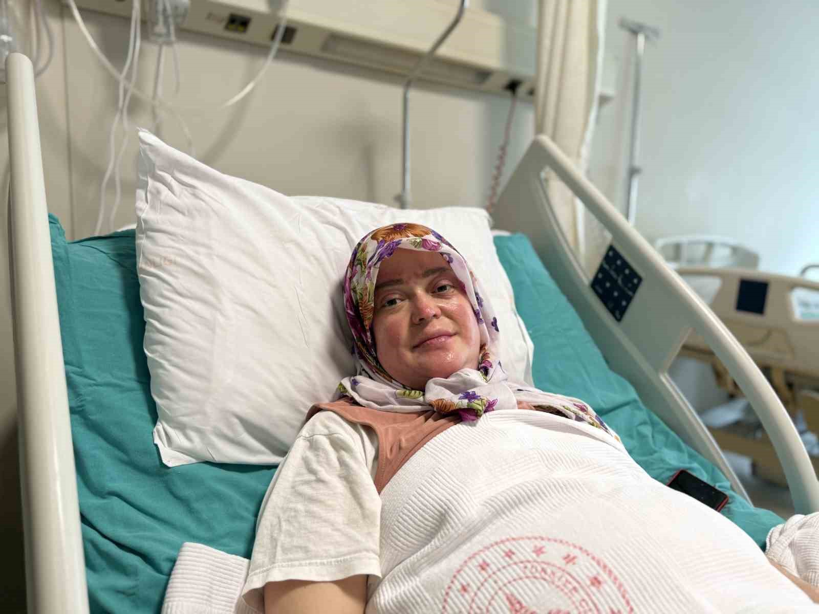 karavandaki-patlama-sonrasi-vucudunun-yuzde-70i-yandi-karadeniz-turu-yapacaktik-alev-topuna-dondum